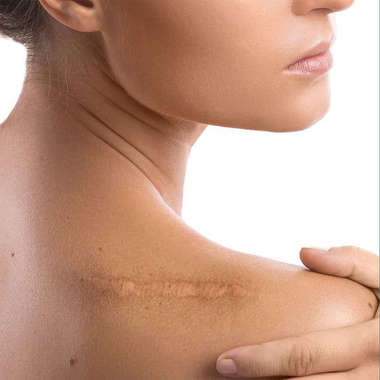 7-8 November 2026 Wellington Restore Oncology Scar Specialist Course
