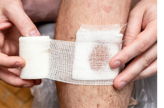 Compression Therapy & Wounds 101