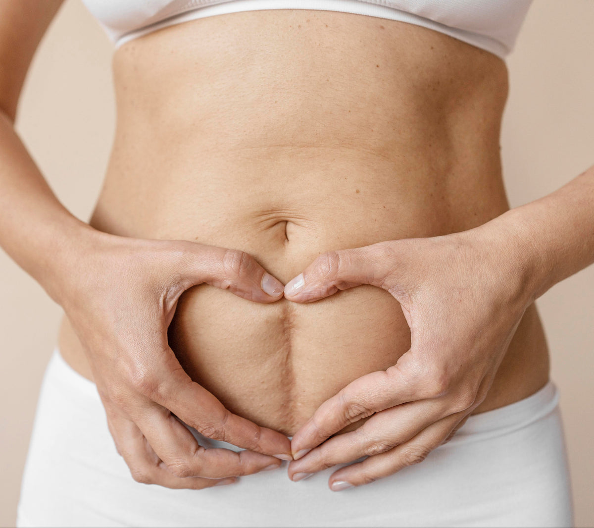 Restore Scar Therapy Workshops NZ