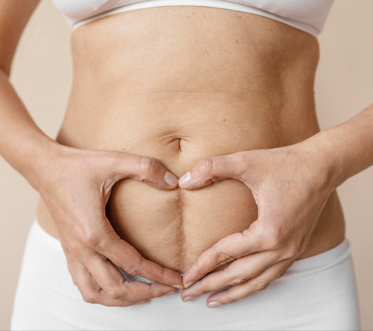 Restore Scar Therapy Workshops NZ